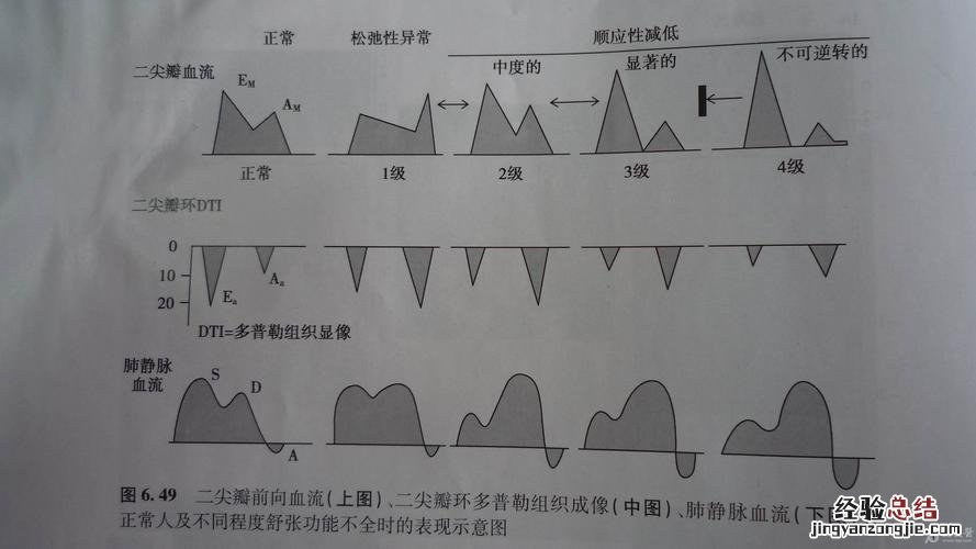 tdi是什么意思