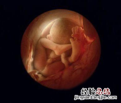 羊水过多对胎儿有什么影响 羊水过多对胎儿有什么影响么