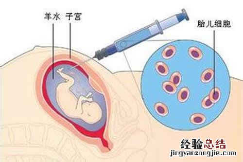 羊水穿刺什么时候做 羊水穿刺什么时候做最安全