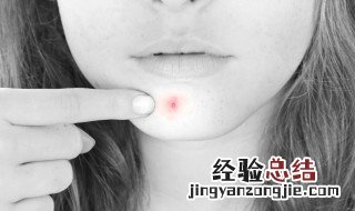 下巴长痘是哪里出现了问题 下巴长痘是哪里的问题