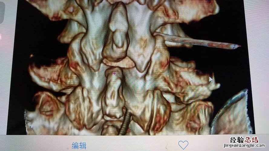 ct三维重建是什么意思