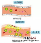 吃什么软化血管最好