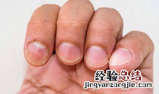 手指月牙怎么补回来的中成药 手指月牙怎么补回来