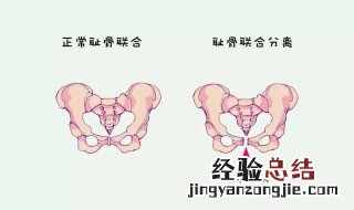 耻骨在哪个位置 耻骨的位置