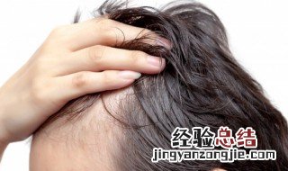 发际线应该怎么修饰 什么发型修饰发际线