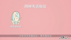 loa胎位是什么意思