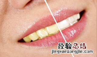 怎么快速美白牙齿 怎么快速美白牙齿的方法