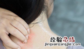 后背发痒怎么治 后背发痒要怎么解决