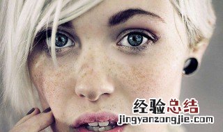 斑是怎么形成的 老年斑是怎么形成的