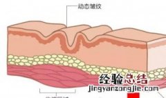 法令纹怎么去除最有效 法令纹怎么去除最有效长久