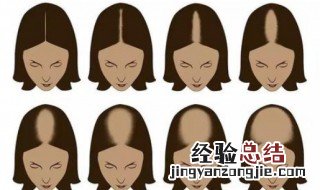 掉头发是怎么回事 掉头发的原因