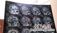 有什么方法可以调节大脑 调节大脑的方法