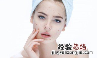 祛痘印方法有哪些 有什么好用的祛痘印方法
