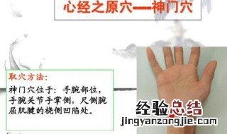 神门穴的准确位置 神门穴在哪里
