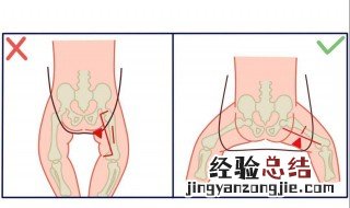 小孩5岁多有些罗圈怎么办 罗圈腿怎么矫正