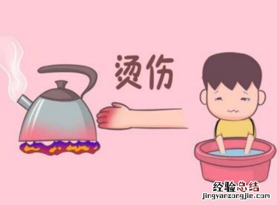 如何对儿童烫伤进行处理 儿童烫伤应怎么处理