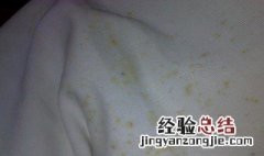 汗渍发霉如何清洗 汗渍发霉如何清洗掉