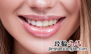 做梦梦到掉牙 做梦梦到掉牙齿是什么预兆女人