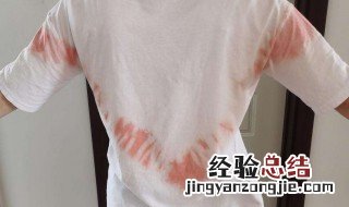 如何巧妙去除衣服染上的色 如何巧妙去除衣服染上的色素