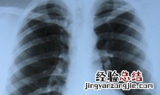 肺部小结节是什么意思 肺部小结节指的是什么