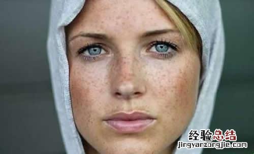 怀孕期长斑怎么办 孕妇长斑怎么办