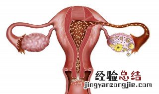 宫外孕怎么办处理方法 第二次宫外孕怎么办处理方法