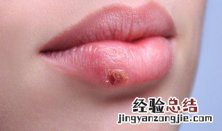 嘴唇厚该怎么办 嘴唇厚该怎么办?