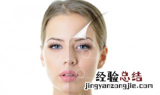 用什么去斑方法最好用 用什么去斑方法最好