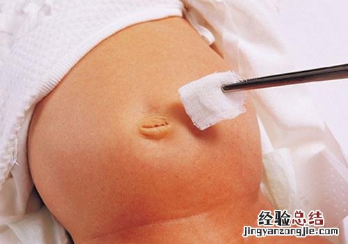 宝宝脐带消毒用酒精还是碘伏 小孩脐带消毒用酒精还是碘伏