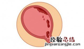 什么是恶露 恶露的含义