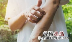 怎么去除手汗症 如何去除手汗的小妙招