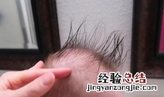形容头发稀疏的古文句子 形容头发稀疏的古文句子搞笑