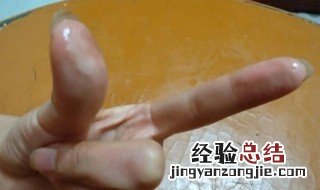 快速去除502胶水小妙方 被胶水弄到手怎么才能洗掉