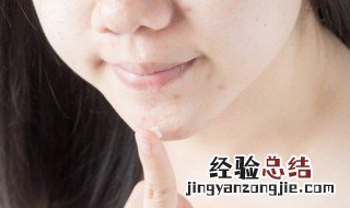 脸颊长痘痘什么原因 脸颊长痘痘有哪些原因