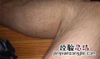 如何让腿毛消失而且永远不长 如何让腿毛消失