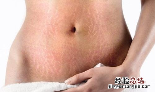 妊娠纹生完孩子会自己消失吗 妊娠纹以后生了孩子能消失吗?