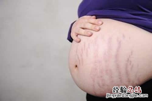 孕期妊娠纹什么时候开始长 妊娠纹什么时候开始长