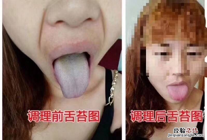 女人口臭什么原因引起，严重了是身体哪里出问题了？怎样去除