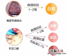 疱疹性咽峡炎和手足口病的区别是什么 疱疹性咽峡炎和手足口病的区别