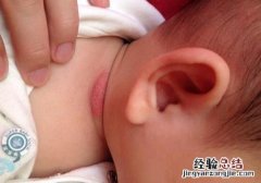 宝宝脖子淹了抹什么好得快 宝宝淹脖子擦什么好