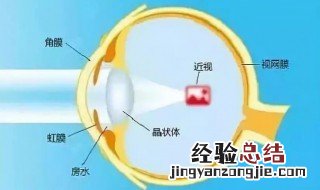 眼镜轴距是指什么 眼镜轴距指的是什么