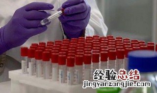 进京没有核酸报告怎么办呢 如果进京没有核酸报告怎么办