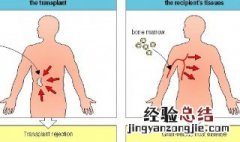 gvhr医学上是什么意思 gvhr医学上的意思