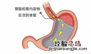 怎样养胃护胃 怎样养胃护胃好