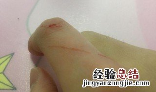 被猫抓了一定要打针吗? 破一点点 被猫抓了一定要打针吗