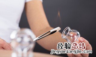 拔罐注意事项和禁忌 拔罐注意事项和禁忌症有哪些