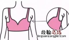 有副乳怎么消除 16岁有副乳怎么消除