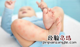 婴儿怎么驱蚊子小妙招 新生儿驱蚊小妙招有哪些