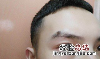 男人眉毛有痣代表什么 男人眉毛有痣代表什么运势