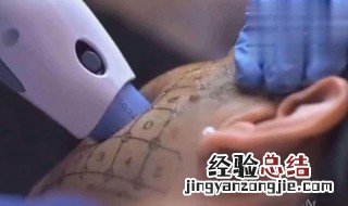 热玛吉后吃什么恢复快 热玛吉做完后吃什么